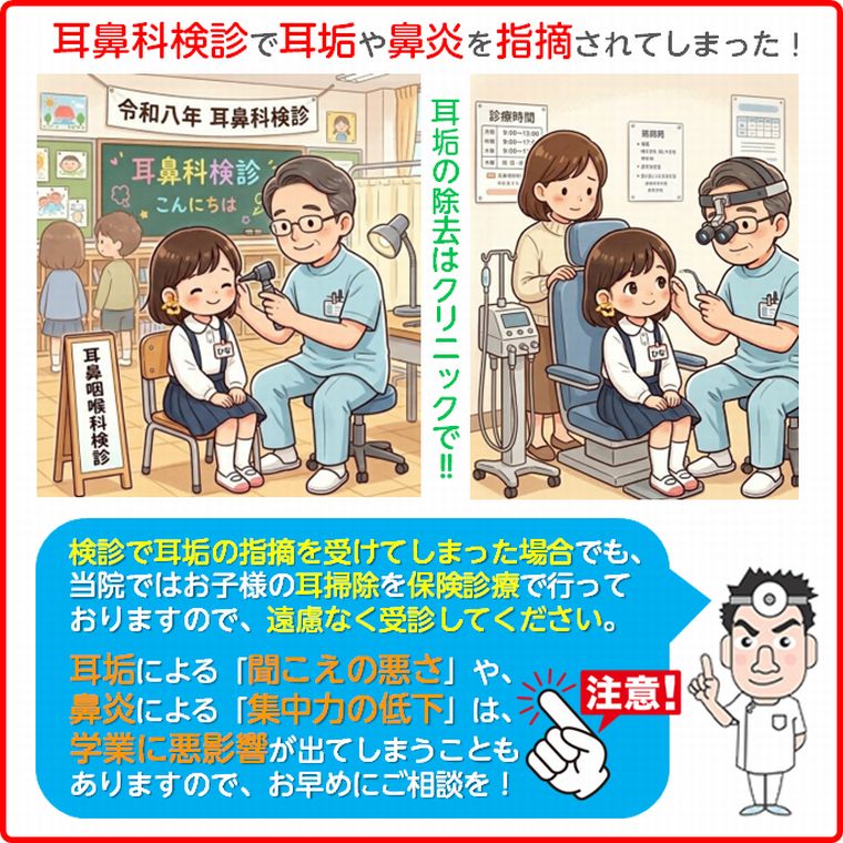 耳鼻科検診で耳垢を指摘されてしまったら